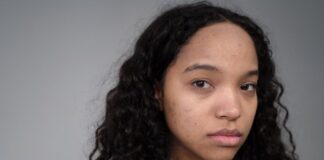 The Ultimate 📊 Acne Scar Cream Guide for Beginners - Professional image